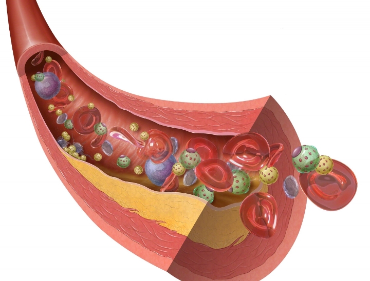 Koefisien aterogenisitas dihitung dengan formula dan menunjukkan ada atau tidak adanya aterosklerosis