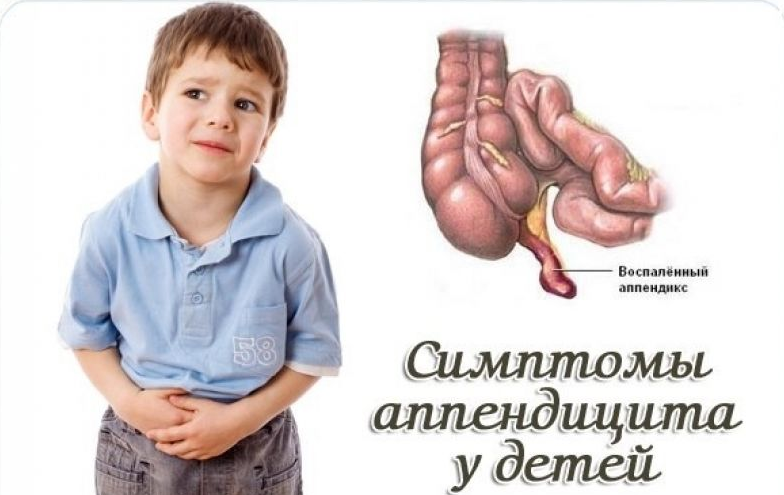 Tanda -Tanda Apendisitis Akut pada Anak -anak