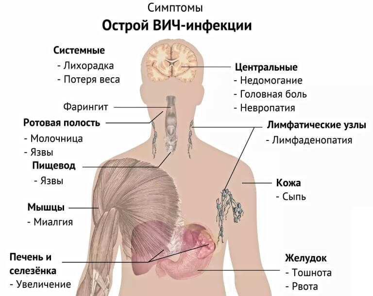 Признаки острой стадии