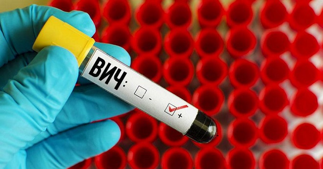 HIV tidak fatal