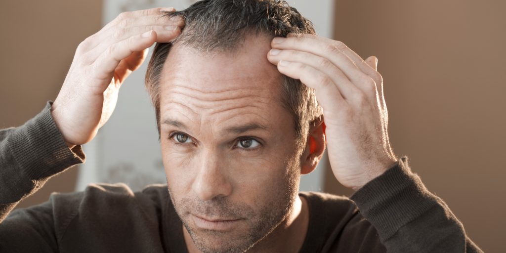 Je možné rozmazat plešatost na hlavě jódem?