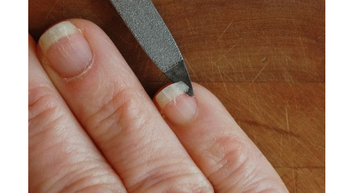 Трещины на ногте из-за неправильных манипуляций во время самостоятельного маникюра