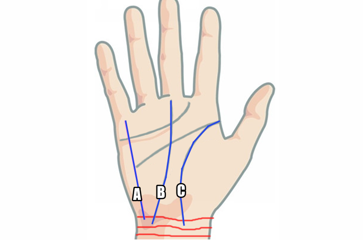 Linjer på armband på handleden